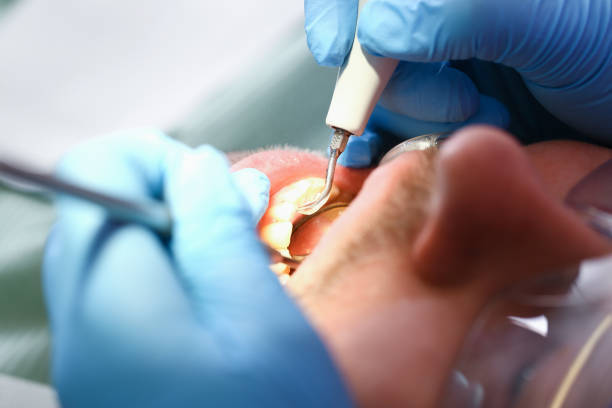 Best Pediatric Emergency Dentist in Riva, MD