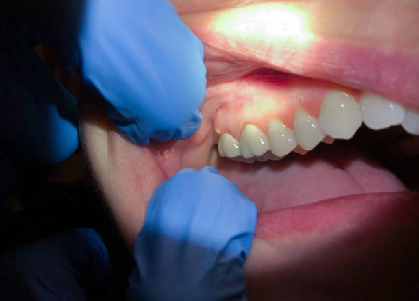 Best Emergency Dentist for Special Needs Patients in Riva, MD